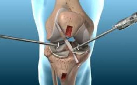 How to Choose the Best Arthroscopy Surgery In India?