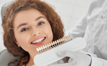 What Are the Different Types of Dental Veneers? A Guide for Prairie Village