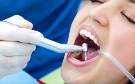 Should You Replace Your Old Silver Fillings in Killeen, TX?