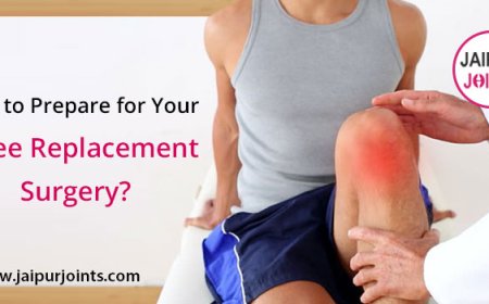 How to Prepare for a Successful Knee Replacement Surgery