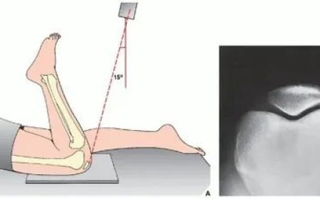 Ergonomic Benefits of X Ray Positioning Aids