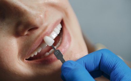 Dental Implants Bundoora: Restoring Smiles, One Tooth at a Time