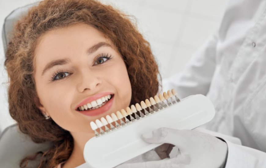 What Are the Different Types of Dental Veneers? A Guide for Prairie Village