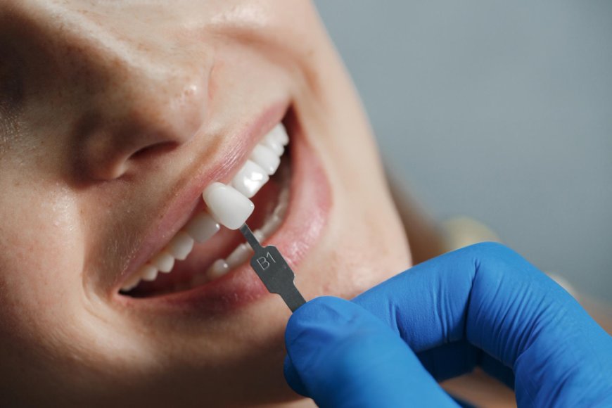 Dental Implants Bundoora: Restoring Smiles, One Tooth at a Time