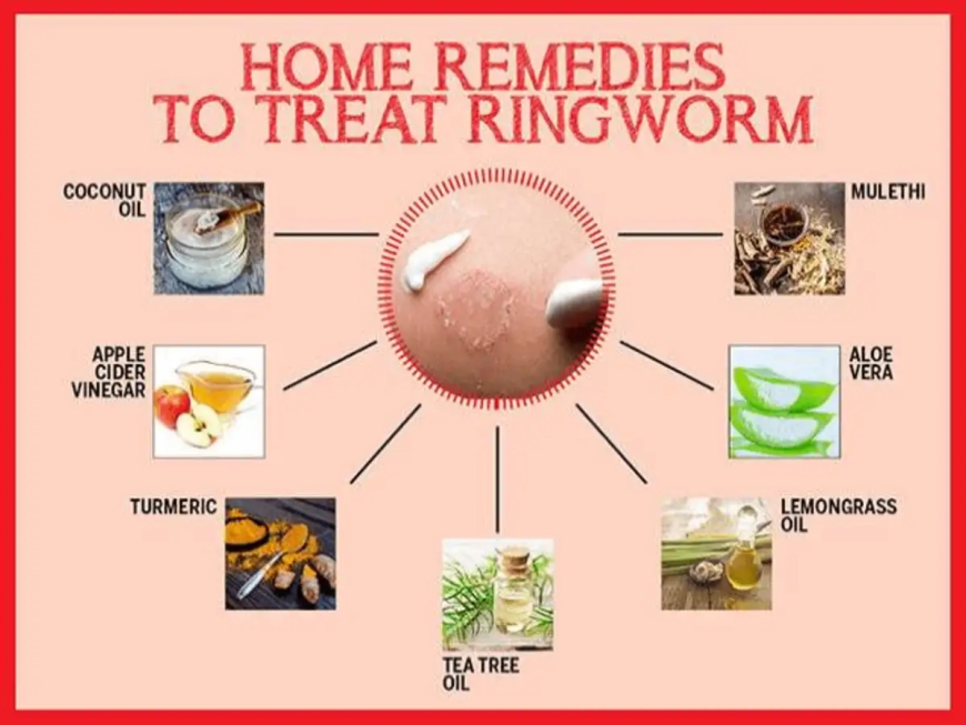 Effective Home Remedy for Ringworm: Natural Ways to Combat Fungal Infection