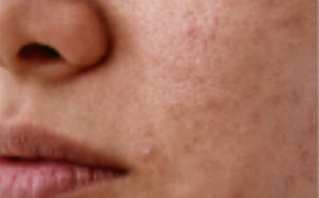 The Secret to Healthy, Youthful Skin: Expert Care Makes All the Difference