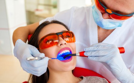 How Teeth Polishing Improve Oral Health and Smile Aesthetics