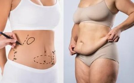 Mommy Makeover Surgeon in Beverly Hills – Restore Your Pre-Baby Confidence