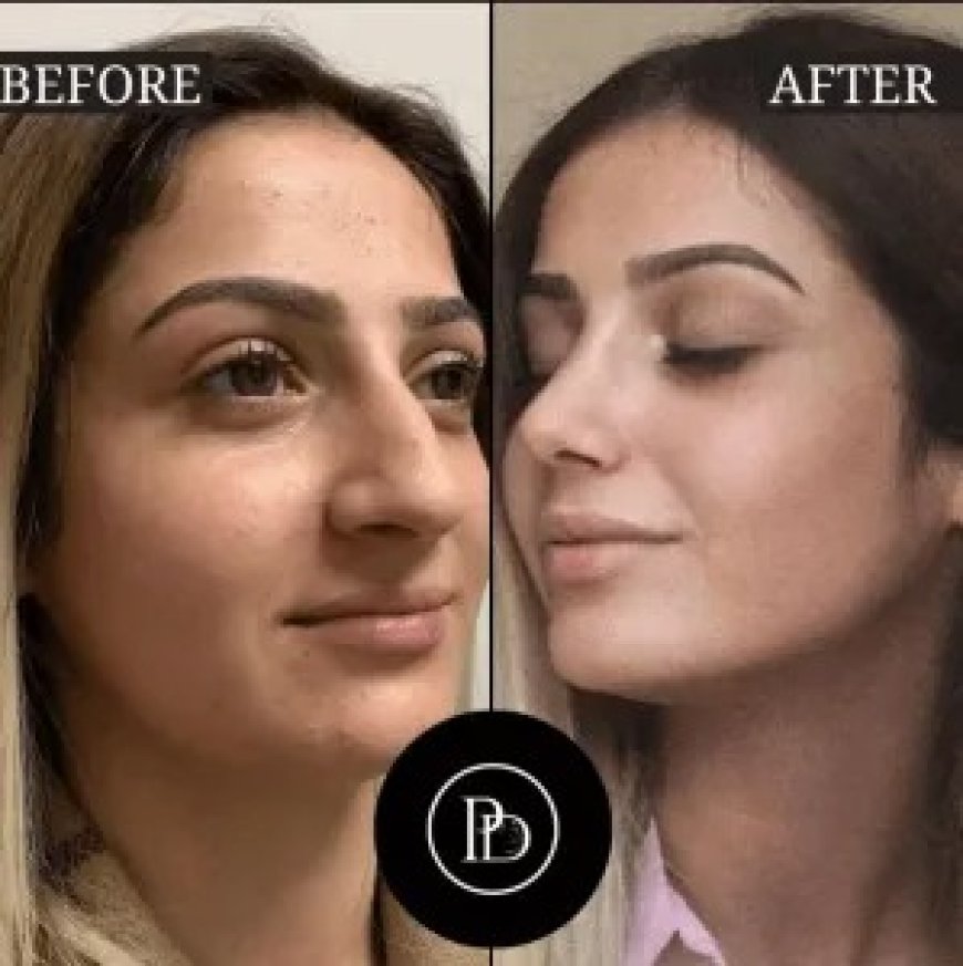 Flawless Skin Journey with the Best Aesthetic Clinic in Dubai – Perfectdrs
