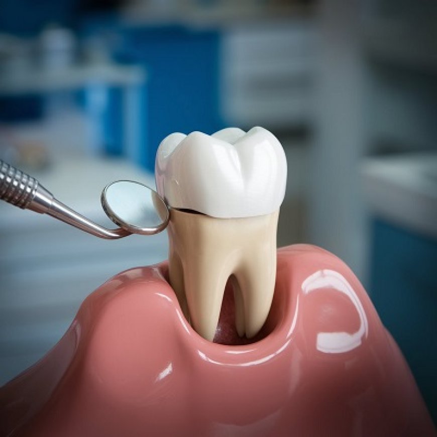 Painless Dental Crown Procedure for Damaged Teeth
