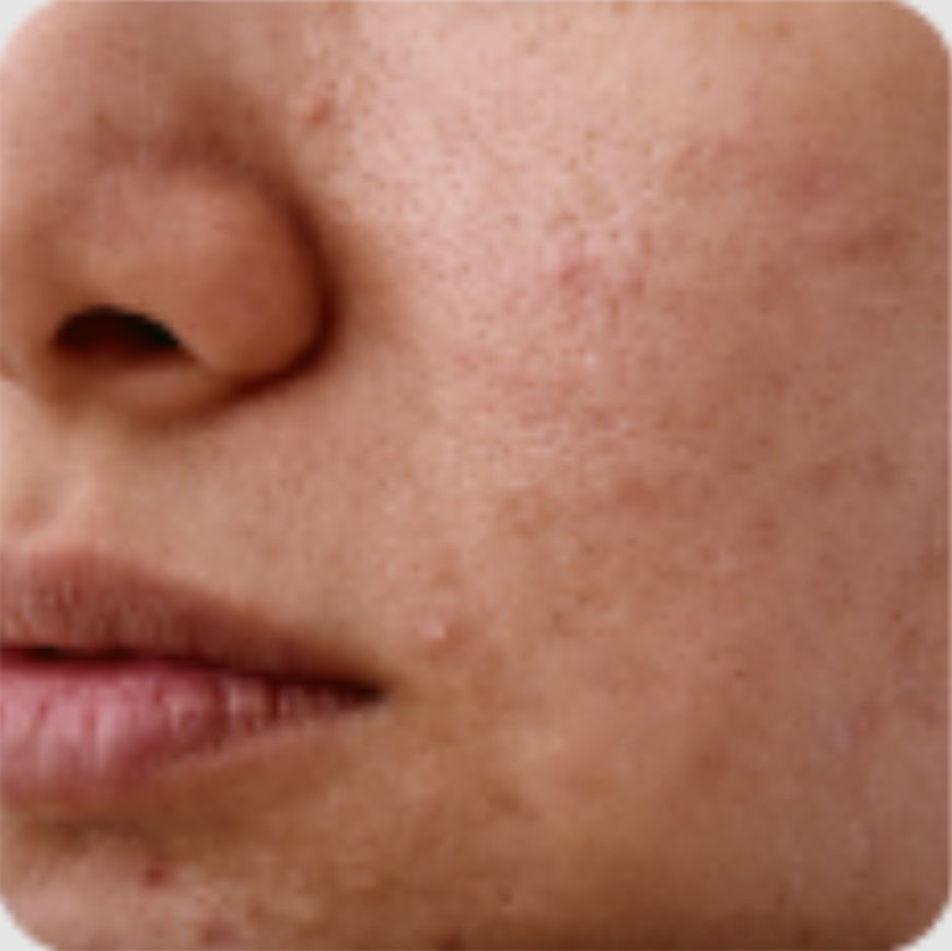 The Secret to Healthy, Youthful Skin: Expert Care Makes All the Difference