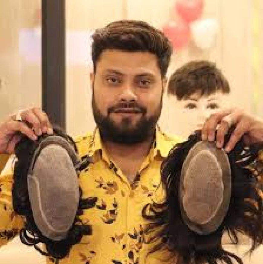 Affordable Hair Patch Service in Delhi for Men & Women
