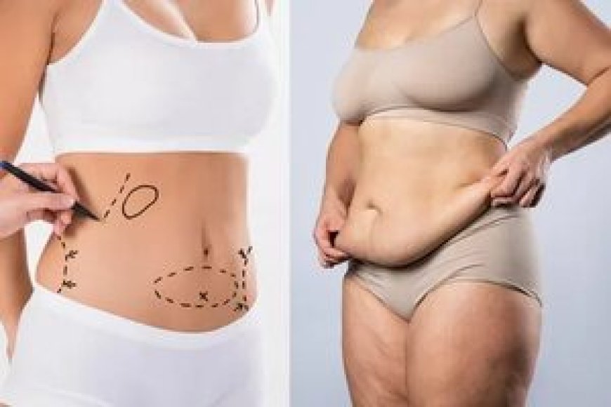 Mommy Makeover Surgeon in Beverly Hills – Restore Your Pre-Baby Confidence